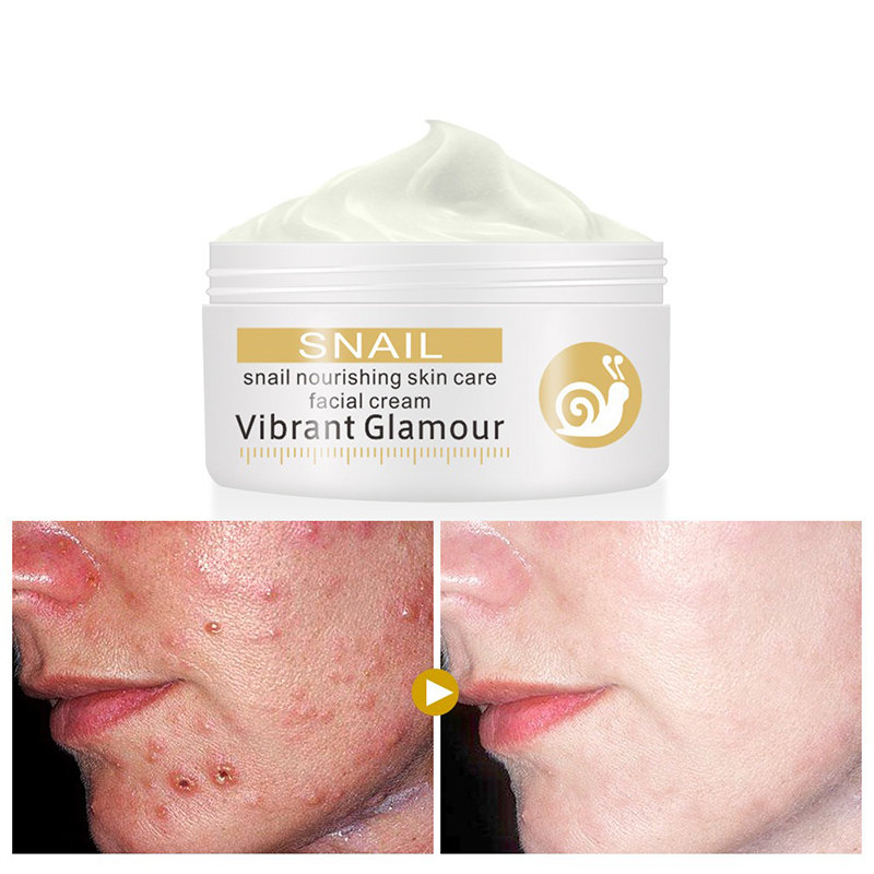 Snail Whitening Freckle Face Cream